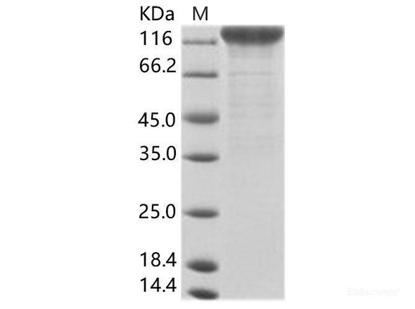 CyCMV (strain OT-1) glycoRecombinant Protein B / GB Recombinant Protein (Fc Tag) (RPES6984)