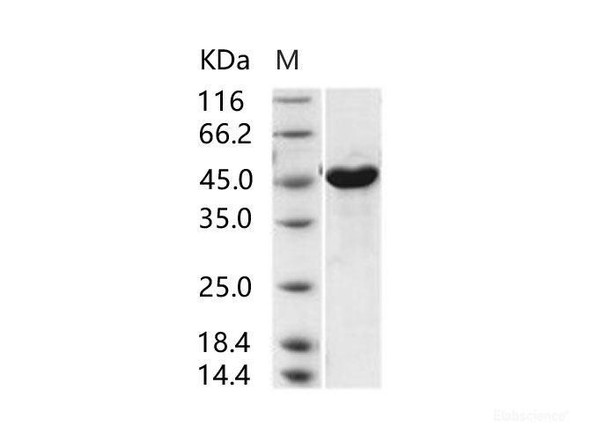 MERS-CoV NucleoRecombinant Protein / NP Recombinant Protein (His Tag) (RPES6985)