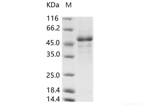 Rift Valley fever virus (RVFV) (strain MP12) glycoRecombinant Protein / G1 Recombinant Protein (His Tag) (RPES6995)