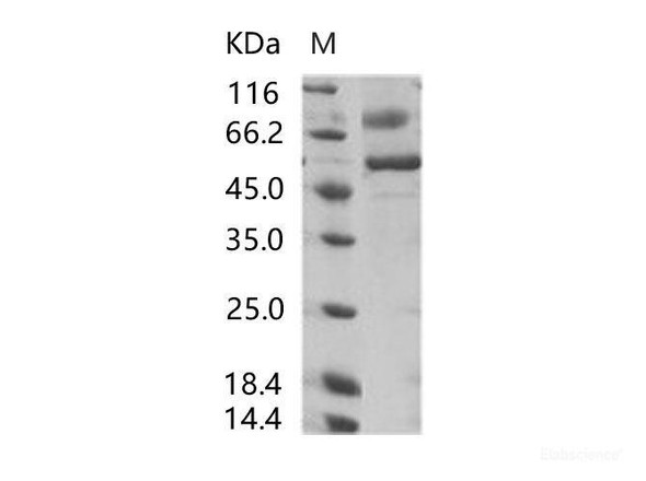 SARS-CoV Spike/RBD Recombinant Protein (RBD, rFc Tag) (RPES7002)