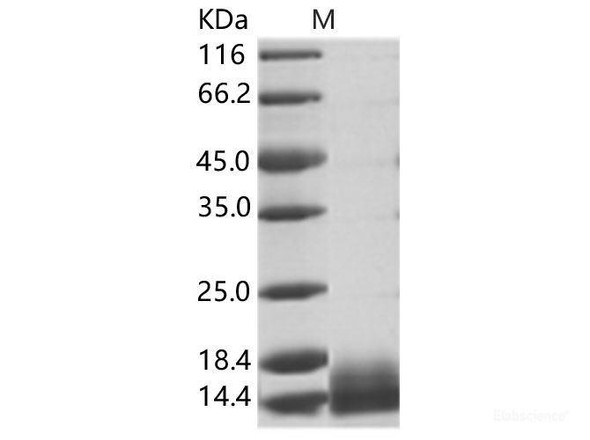 WNV (lineage 1, strain NY99) E / Envelope Recombinant Protein (Domain III, His Tag) (RPES7008)