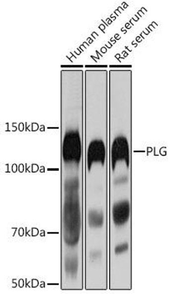 Anti-PLG Antibody (CAB3320)