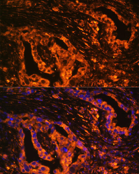 Anti-SCNN1A Antibody (CAB5538)