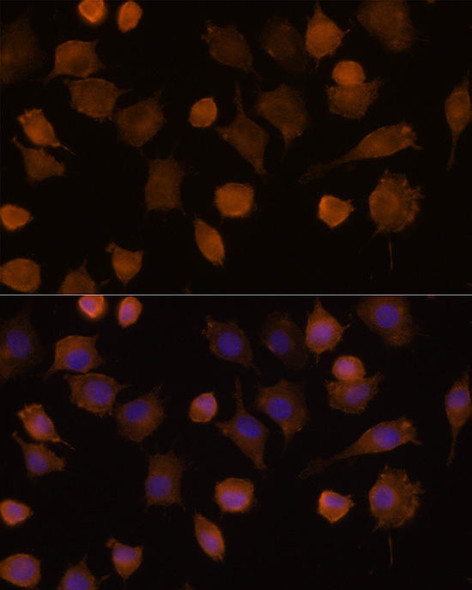 Anti-ICAM1 Antibody (CAB5597)