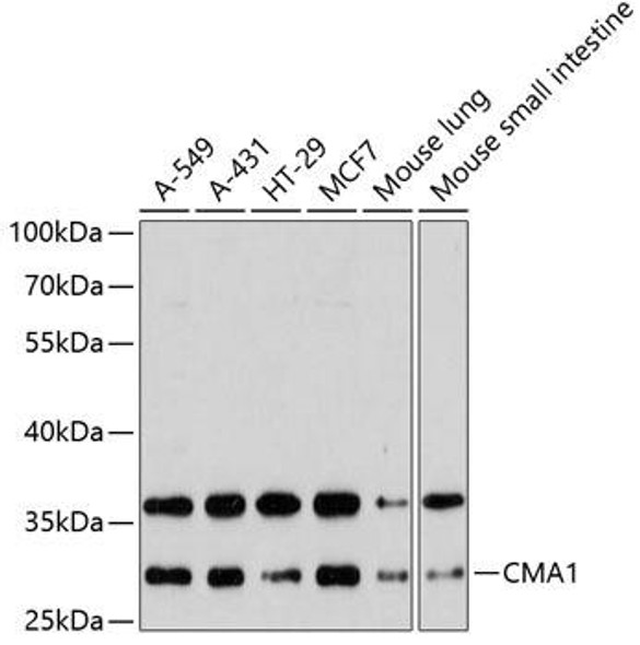 Anti-CMA1 Antibody (CAB5668)