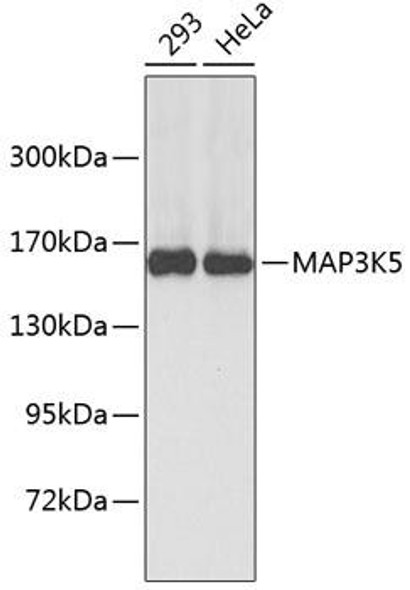Anti-MAP3K5 Antibody (CAB6274)