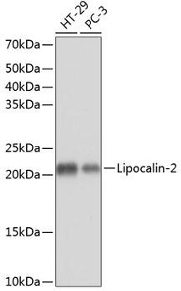 Anti-Lipocalin-2 Antibody (CAB11207)