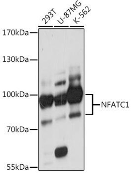 Anti-NFATC1 Antibody (CAB16928)