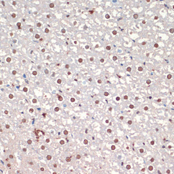 Anti-TARDBP Antibody (CAB17114)