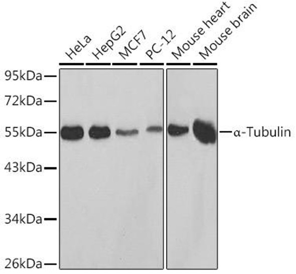α-Tubulin Rabbit Polyclonal Antibody (CABC014)