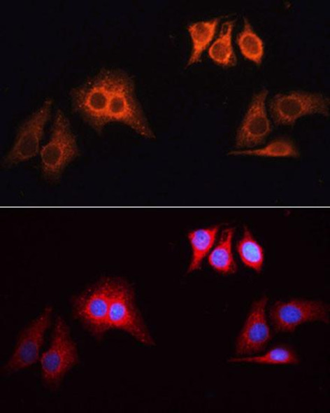 Rhodamine (TRITC)-conjugated Goat anti-Rabbit IgG (H+L) (CABS040)