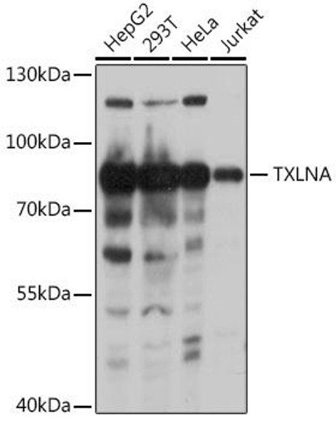 Anti-TXLNA Antibody (CAB18291)