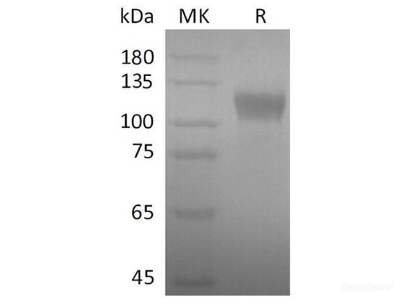SARS-CoV-2 Spike S1 Recombinant Protein (RPES0017)