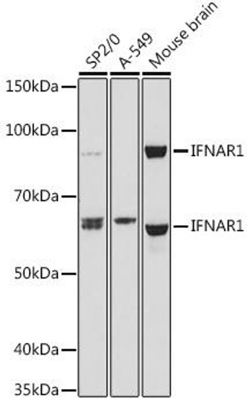 Anti-IFNAR1 Antibody (CAB18594)