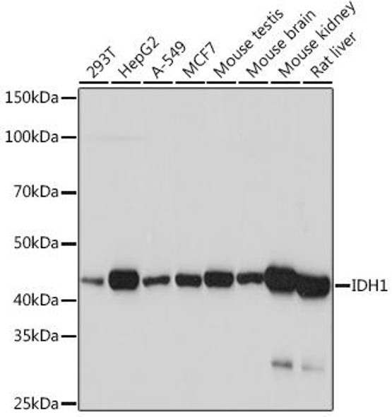 Anti-IDH1 Antibody (CAB5106)