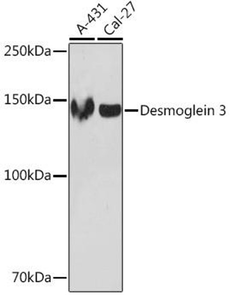Anti-Desmoglein 3 Antibody (CAB5227)