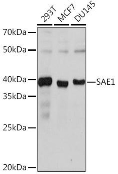 Anti-SAE1 Antibody (CAB0891)