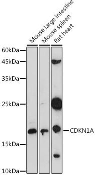 Anti-CDKN1A Antibody (CAB20471)