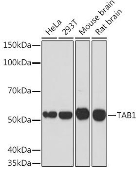 Anti-TAB1 Antibody (CAB3306)