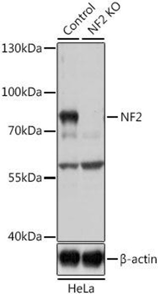 Anti-NF2 Antibody (CAB0739)[KO Validated]