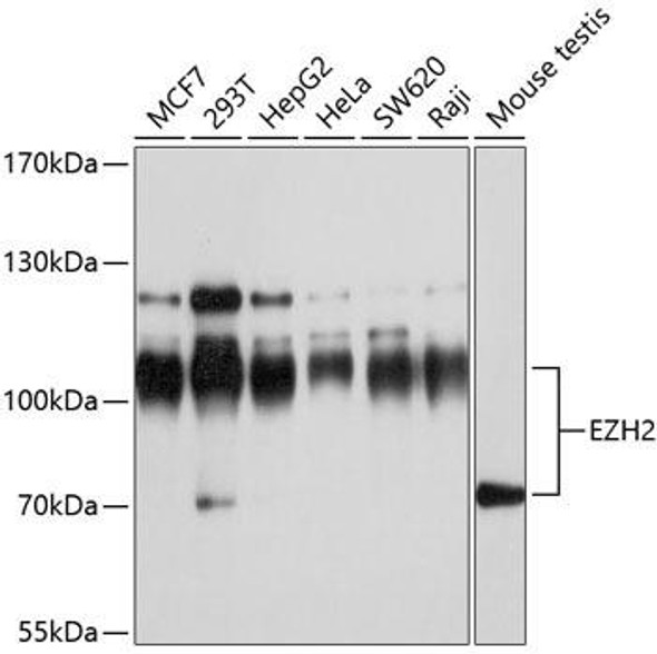 Anti-EZH2 Antibody (CAB11085)[KO Validated]