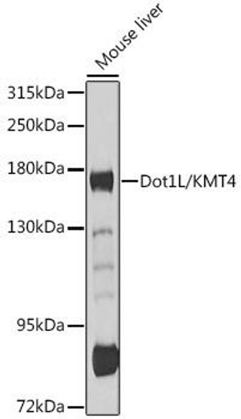 Anti-Dot1L/KMT4 Antibody (CAB11285)