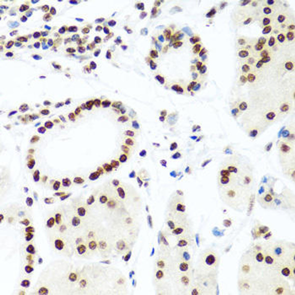 Anti-Histone H2AX Antibody (CAB11361)