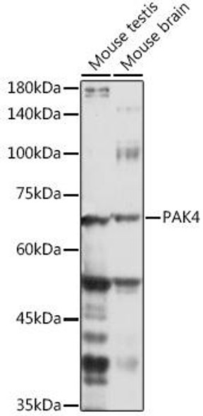 Anti-PAK4 Antibody (CAB11646)