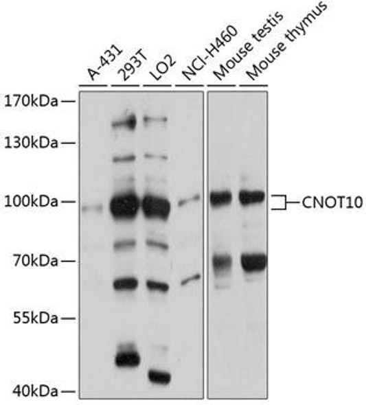 Anti-CNOT10 Antibody (CAB12164)