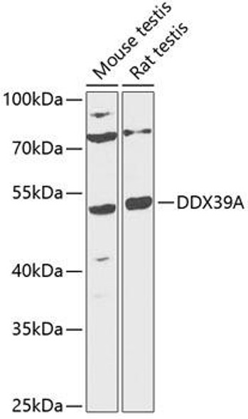 Anti-DDX39A Antibody (CAB12558)