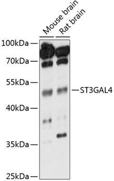 Anti-ST3GAL4 Antibody (CAB14491)