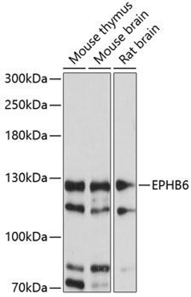 Anti-EPHB6 Antibody (CAB14729)