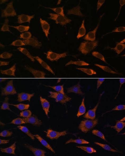 Anti-RPS25 Antibody (CAB15314)