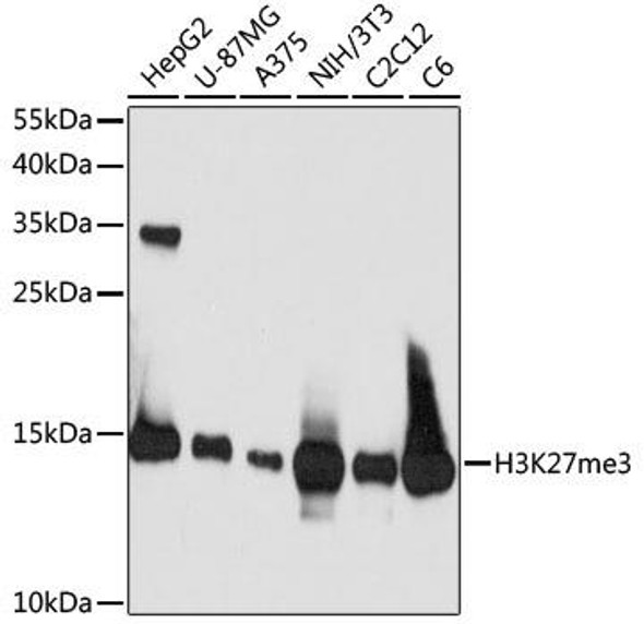 Anti-TriMethyl-Histone H3-K27 Antibody (CAB16199)