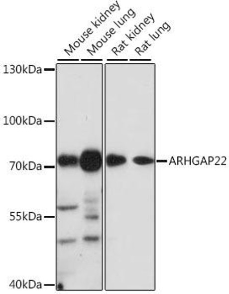 Anti-ARHGAP22 Antibody (CAB16566)