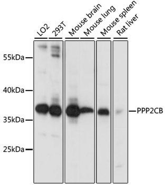 Anti-PPP2CB Antibody (CAB3122)