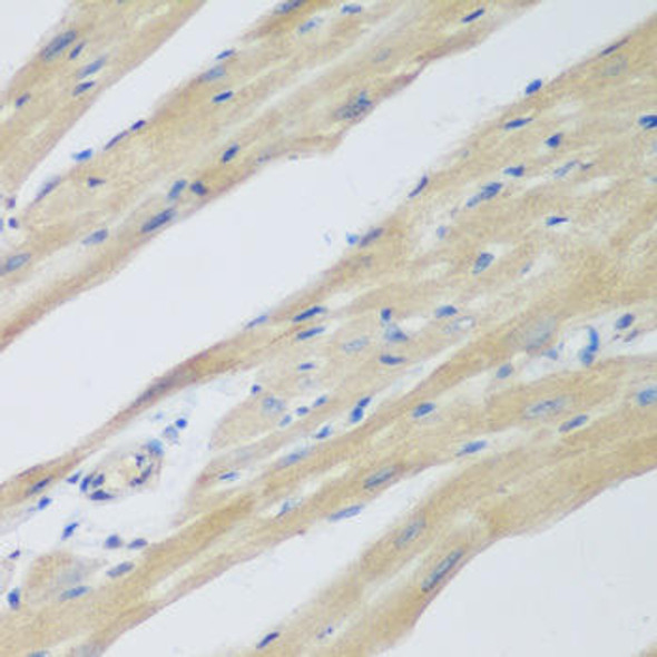 Anti-WDR77 Antibody (CAB7134)