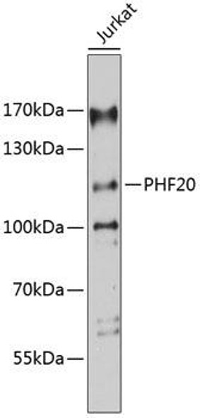 Anti-PHF20 Antibody (CAB9489)