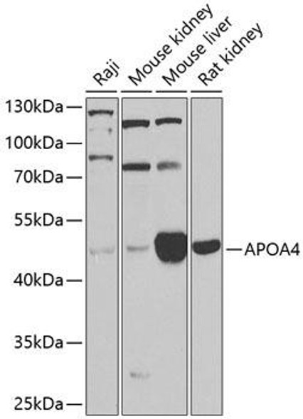 Anti-Apolipoprotein A-IV Antibody (CAB9792)