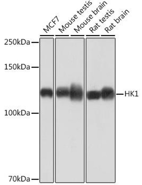 Anti-HK1[KO Validated] Antibody (CAB0533)