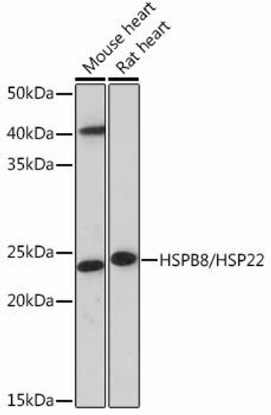 Anti-HSPB8/HSP22 Antibody (CAB13518)