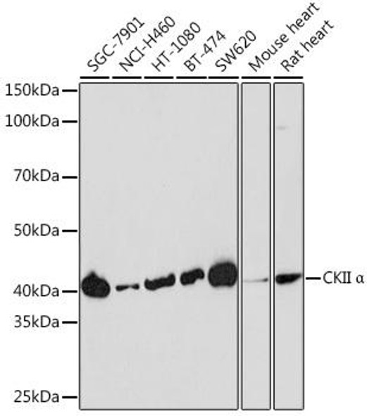 Anti-CKII Alpha Antibody (CAB19683)