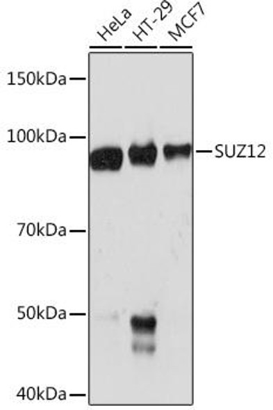 Anti-SUZ12 Antibody (CAB4348)