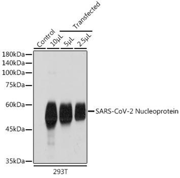 Anti-SARS-CoV-2 Nucleoprotein Antibody (CAB18797)