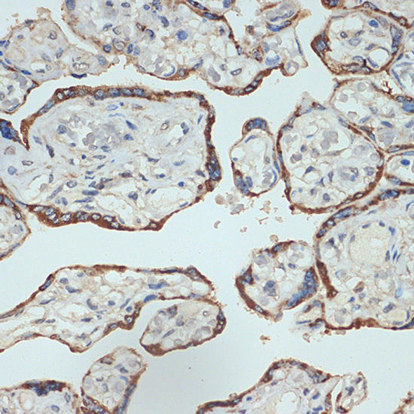 Anti-Placental lactogen (CSH1) Antibody (CAB19258)