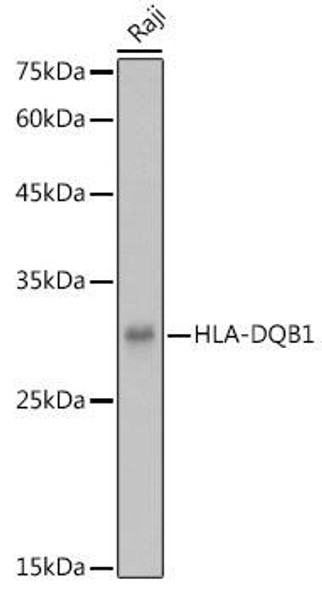 Anti-HLA-DQB1 Antibody (CAB20372)
