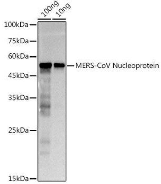 Anti-MERS-CoV Nucleoprotein Antibody (CAB20594)