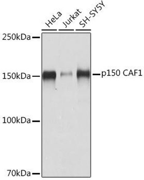 Anti-p150 CAF1 Antibody (CAB8725)