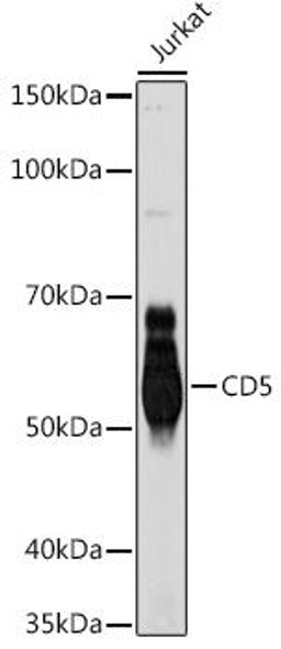 Anti-CD5 Antibody (CAB9557)