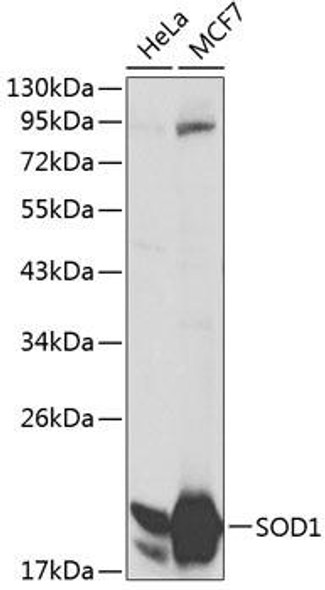 Anti-SOD1 Antibody (CAB0274)